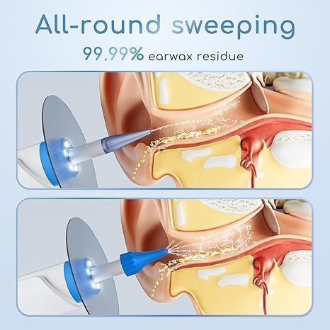 Earwax Removal - Electric Ear Irrigation Kit with 4 Pressure Modes, Ear Cleaner with Camera, 1080P Otoscope, Ear Cleaning Tool with 7-Piece Set, Earwax Removal Kit for Daily Cleaning-Bluewhite