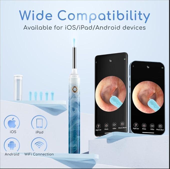 Earwax Removal - Electric Ear Irrigation Kit with 4 Pressure Modes, Ear Cleaner with Camera, 1080P Otoscope, Ear Cleaning Tool with 7-Piece Set, Earwax Removal Kit for Daily Cleaning-Bluewhite