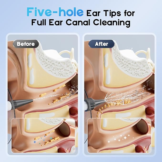 Ear Wax Removal - Ear Cleaner with 4 Pressure Modes, Ear Cleaning Kit with Digital Temperature Display, Safe & Effective Ear Irrigation Flushing System (White)
