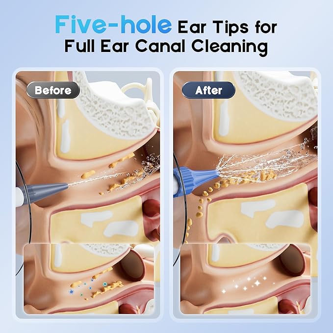 Ear Wax Removal, Electric Ear Cleaning Kit with Light, FSA-HSA-Eligible, Ear Irrigation Kit with 4 Pressure Modes, Safe and Effective Ear Flush Kit with Ear Cleaner - Includes Basin, Towel & 15 Tips