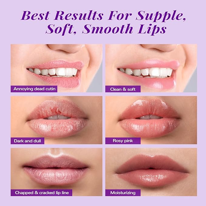 ANAI RUI Lip Therapy Set, Lip Scrub & Lip Mask, Overnight Hydrating Lip Moisturizer with Exfoliator Scrub, Lip Sleeping Mask for Plumping, Lip Gift Kit for Dry, Chapped, Dark Lips, Grape