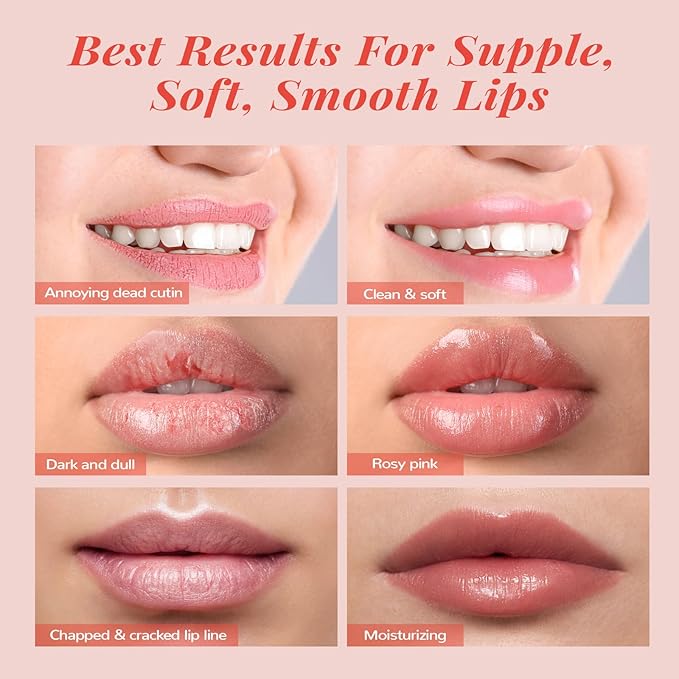 Hydrating Lip Mask Set, Lip Scrub & Lip Butter, Overnight Lip Treatment Set Enriched With Ceramide, Watermelon and Shea Butter, For A Softer & Smoother Lips, Overnight Lip Mask Gifts