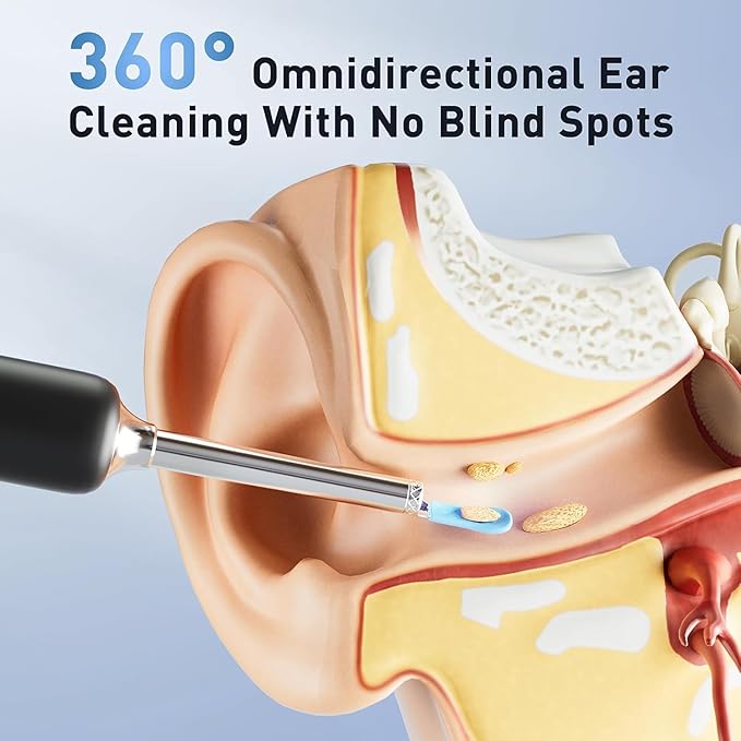 Ear Wax Removal - Electric Ear Irrigation Flushing System with 4 Pressure Modes, Ear Cleaner with Camera, 1080P Otoscope, Ear Cleaning Tool with 7 Pcs Ear Set, Safe and Effective Earwax Removal Kit