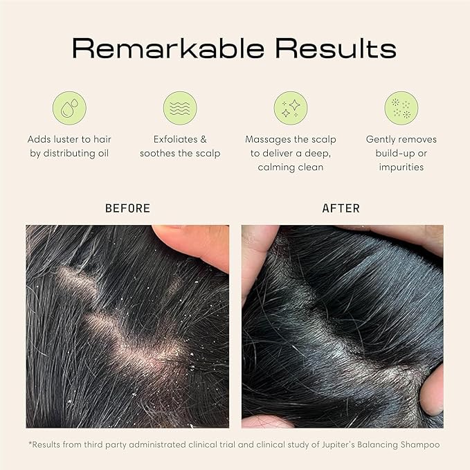 Jupiter Scalp Exfoliator - Scalp Massager Tool for Wet & Dry Hair - Ergonomic Detangler Brush - Dandruff Comb & Scrub to Remove Dandruff & Buildup and Support Circulation - Purple