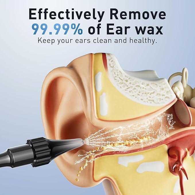 Ear Wax Removal - Electric Ear Irrigation Flushing System with 4 Pressure Modes, Ear Cleaner with Camera, 1080P Otoscope, Ear Cleaning Tool with 7 Pcs Ear Set, Safe and Effective Earwax Removal Kit