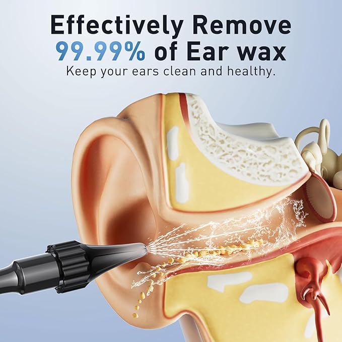 Lebbtl Ear Wax Removal - Electric Ear Irrigation Flushing System, Ear Cleaner with Camera, 1080P Otoscope, Ear Cleaning Tool with 7 Pcs Ear Set, Safe and Effective Earwax Removal Kit