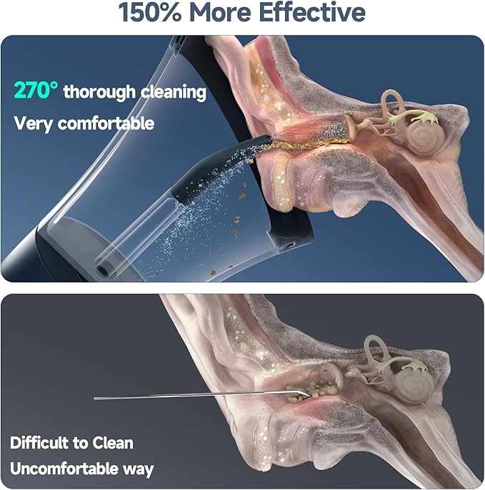 Electric Ear Cleaning Kit Effective & Safe Ear Cleaner Irrigation Flushing System 4 Pressure Modes for Ear Wax Buildup